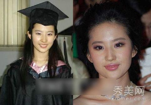 明星爆料整容视频大全下载,视频大全下载解析  第2张